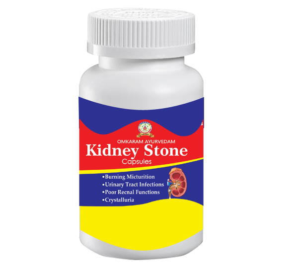 Kidney Stone Remove